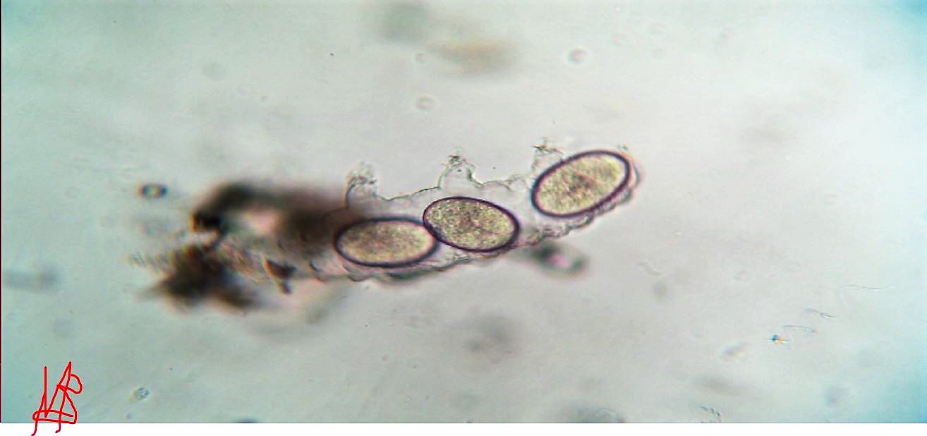 tardigrad(morto ??) con strana infestazione. idee?